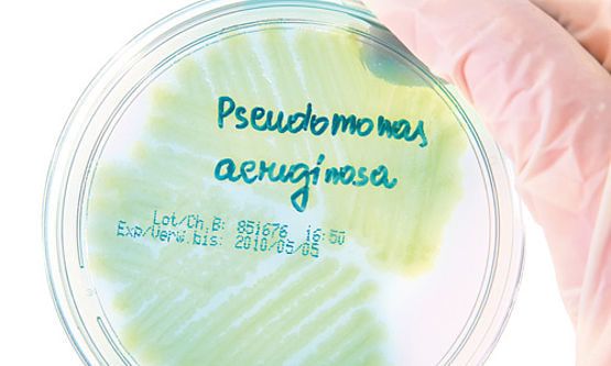 Was sind Pseudomonaden?